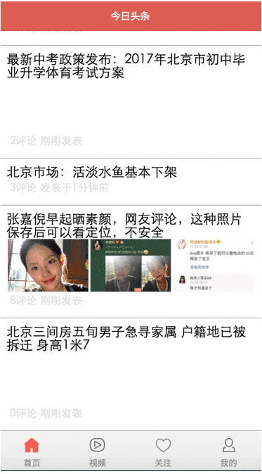 微信小程序:今日头条